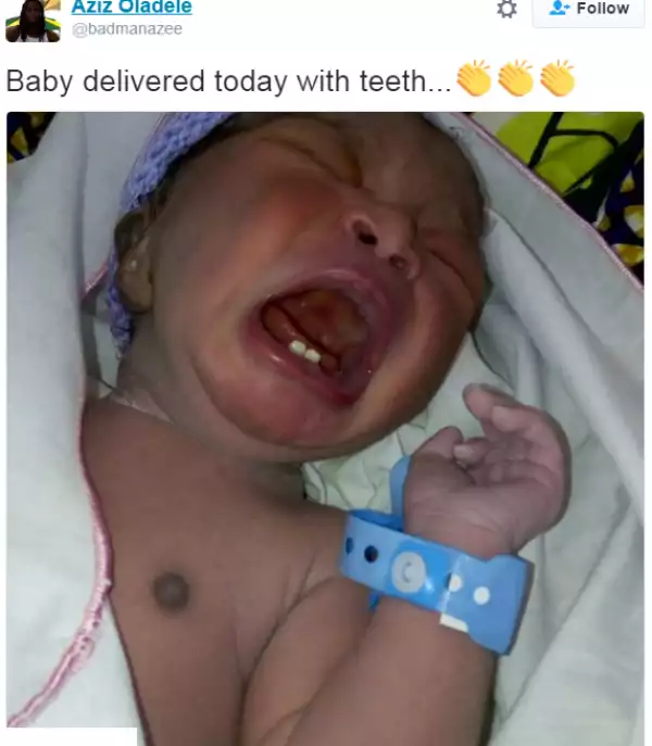 Is this for real? Baby born with teeth (Photo)